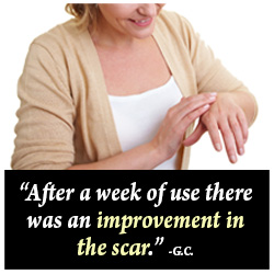 Scar-Ban Scar Lotion Customer Testimonial