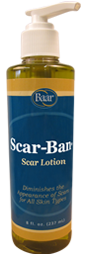 Scarban All Natural Scar Massage Lotion